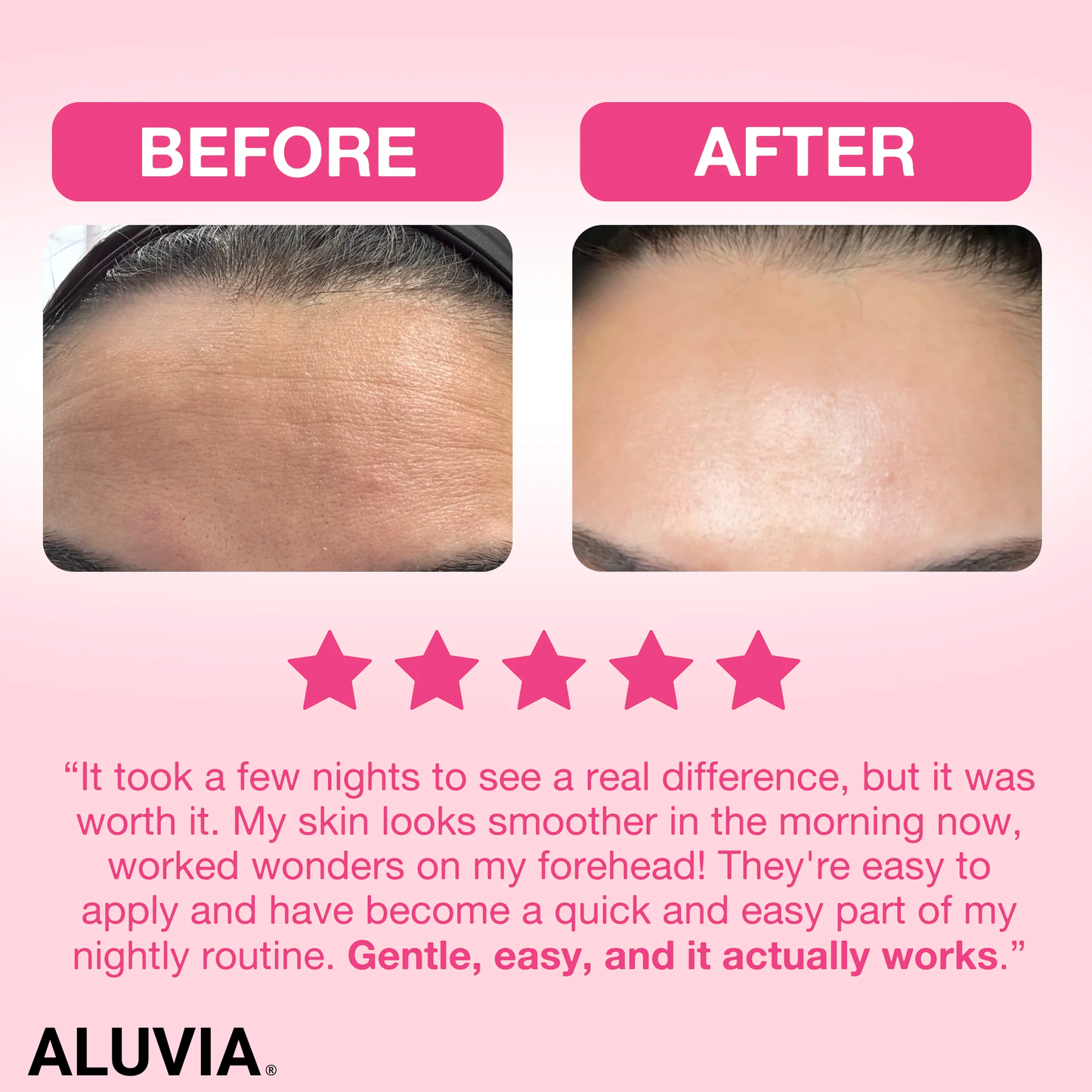 ALUVIA™ Anti-Wrinkle Face Lift Strips- 110 Pcs